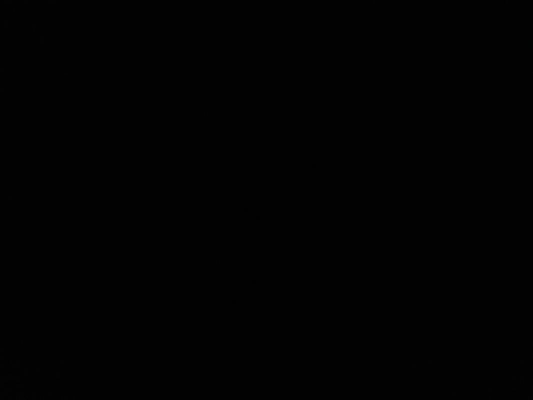 Triangolo inferiore anteriore destro